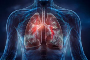 Battling Tuberculosis: A Full-Spectrum Insight into Tuberculosis- Part 2